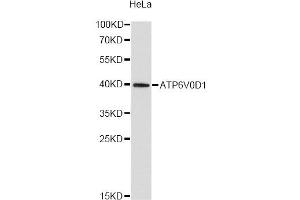 Western blot analysis of extracts of HeLa cells, using ATP6V0D1 antibody. (ATP6V0D1 anticorps)