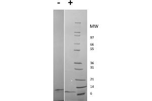 SDS-PAGE of Rat Epidermal Growth Factor Recombinant Protein SDS-PAGE of Rat Epidermal Growth Factor Recombinant Protein. (EGF Protéine)
