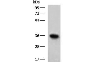 Western blot analysis of Mouse skeletal muscle tissue lysate using TNNT1 Polyclonal Antibody at dilution of 1:550 (TNNT1 anticorps)