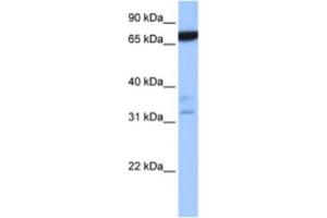 Western Blotting (WB) image for anti-Zinc Finger Protein 340 (ZNF340) antibody (ABIN2463360) (ZBTB46 anticorps)