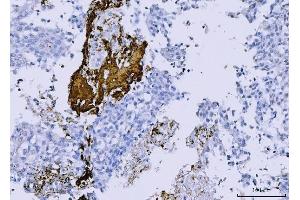IHC analysis of Integrin beta 3/ITGB3 using anti-Integrin beta 3/ITGB3 antibody (ABIN7601139).