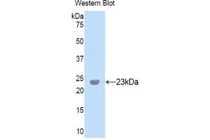 Western blot analysis of the recombinant protein. (Peroxidasin anticorps  (AA 1285-1475))