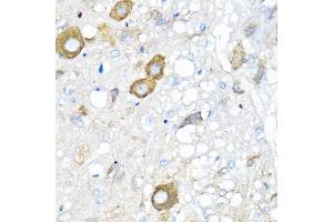 Immunohistochemistry of paraffin-embedded rat brain using MGP antibody (ABIN5975376) at dilution of 1/100 (40x lens). (MGP anticorps)