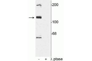 Western blot of rat cortical lysate showing specific immunolabeling of the ~120 kDa TAO2 phosphorylated at Ser181 in the first lane (-). (TAO Kinase 2 anticorps  (pSer181))
