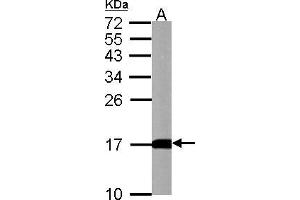 WB Image LC3B antibody detects LC3B protein by western blot analysis.