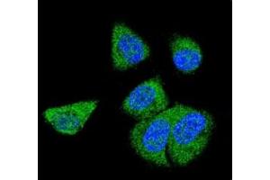 Confocal immunofluorescent analysis of C6 antibody with MDA-MB231 cells followed by Alexa Fluor 488-conjugated goat anti-rabbit lgG (green).