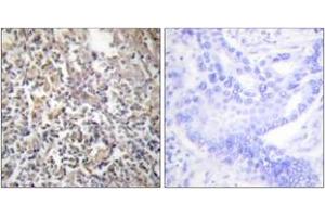 Immunohistochemistry analysis of paraffin-embedded human thyroid gland tissue, using Fibronectin 1 Antibody. (Fibronectin 1 anticorps  (AA 2337-2386))