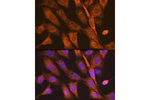 Immunofluorescence analysis of NIH-3T3 cells using PEN2/PSENEN Rabbit mAb (ABIN7269513) at dilution of 1:100 (40x lens). (PEN2 anticorps)