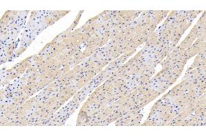 Detection of TGFb1 in Human Cardiac Muscle Tissue using Polyclonal Antibody to Transforming Growth Factor Beta 1 (TGFb1)