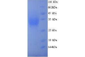 SDS-PAGE (SDS) image for Meteorin, Glial Cell Differentiation Regulator-Like (METRNL) (AA 46-311) protein (His tag) (ABIN5714378)
