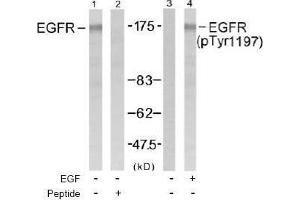 Image no. 1 for anti-Epidermal Growth Factor Receptor (EGFR) (pTyr1197) antibody (ABIN196974) (EGFR anticorps  (pTyr1197))