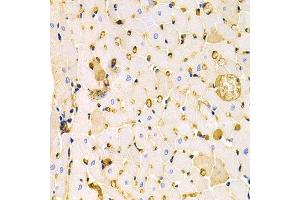 Immunohistochemistry of paraffin-embedded rat heart using KCNH2 antibody at dilution of 1:200 (400x lens). (KCNH2 anticorps)