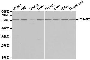 Western blot analysis of extracts of various cell lines, using IFNAR2 antibody (ABIN5970890) at 1/1000 dilution. (IFNAR2 anticorps)