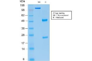 SDS-PAGE Analysis Purified p21 Mouse Recombinant Monoclonal Antibody (rCIP1/823). (Recombinant p21 anticorps)