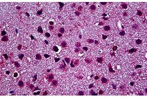 Mouse Brain: Formalin-Fixed, Paraffin-Embedded (FFPE)