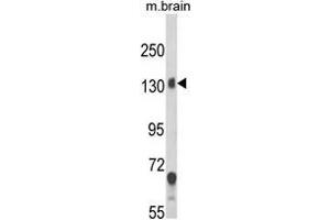Western blot analysis of CACNA2D1 Antibody (N-term) in mouse brain tissue lysates (35ug/lane). (CACNA2D1 anticorps  (N-Term))