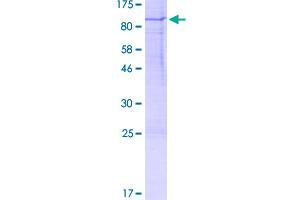 Image no. 1 for Ribosomal Protein S6 Kinase, 70kDa, Polypeptide 1 (RPS6KB1) (AA 1-525) protein (GST tag) (ABIN1318838)
