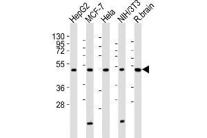 All lanes : Anti-P2R2A Antibody (N-term) at 1:2000 dilution Lane 1: HepG2 whole cell lysates Lane 2: MCF-7 whole cell lysates Lane 3: Hela whole cell lysates Lane 4: NIH/3T3 whole cell lysates Lane 5: rat brain lysates Lysates/proteins at 20 μg per lane. (PPP2R2A anticorps  (N-Term))