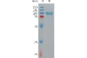 Cynomolgus CD93 Protein, His Tag on SDS-PAGE under reducing condition.