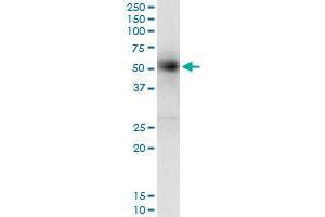 Immunoprecipitation of GAK transfected lysate using anti-GAK monoclonal antibody and Protein A Magnetic Bead , and immunoblotted with GAK monoclonal antibody.