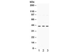 Western blot testing of 1) rat kidney, 2) human HeLa, and 3) human A549 lysate with SAPK4 antibody.