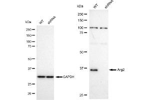Western blotting analysis using Arg2 antibody (ABIN7797644). (Recombinant ARG2 anticorps)