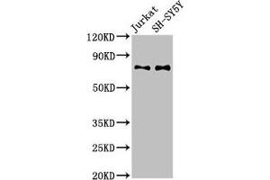 Western Blot Positive WB detected in: Jurkat whole cell lysate, SH-SY5Y whole cell lysate All lanes: RAVER2 antibody at 3 μg/mL Secondary Goat polyclonal to rabbit IgG at 1/50000 dilution Predicted band size: 75, 73 kDa Observed band size: 75 kDa (RAVER2 anticorps  (AA 2-691))