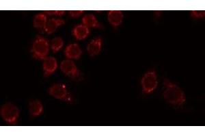 ABIN6275953 staining Hela by IF/ICC. (G Protein-Coupled Receptor 110 anticorps  (C-Term))