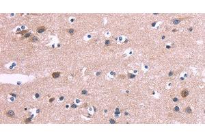 Immunohistochemistry of paraffin-embedded Human brain tissue using DUSP13 Polyclonal Antibody at dilution 1:60