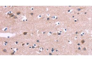 Immunohistochemistry of paraffin-embedded Human brain tissue using DUSP13 Polyclonal Antibody at dilution 1:60 (DUSP13 anticorps)
