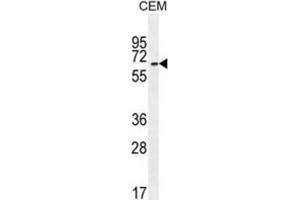 Western Blotting (WB) image for anti-UNC Homeobox (UNCX) antibody (ABIN2996063) (UNCX anticorps)
