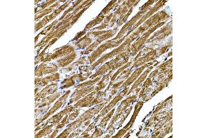 Immunohistochemistry of paraffin-embedded mouse heart using BNP Rabbit pAb (ABIN3023135, ABIN3023136, ABIN3023137, ABIN1513273 and ABIN6219406) at dilution of 1:200 (40x lens). (NPPB anticorps  (AA 1-134))