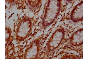 IHC image of ABIN7172255 diluted at 1:100 and staining in paraffin-embedded human colon tissue performed on a Leica BondTM system.