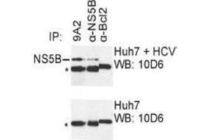 Western Blotting (WB) image for anti-Hepatitis C Virus NS5 (HCV NS5) (AA 111-130) antibody (ABIN781784) (HCV NS5 anticorps  (AA 111-130))