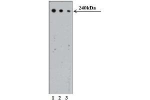 Western blot analysis of CRIK on Human Jurkat cell lysate (ATCC TIB-152). (CIT anticorps  (AA 1420-1612))