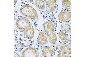 Immunohistochemistry of paraffin-embedded human stomach using FBXL5 antibody at dilution of 1:100 (x40 lens). (FBXL5 anticorps)