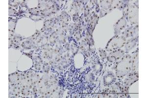 Immunoperoxidase of monoclonal antibody to CDC25C on formalin-fixed paraffin-embedded human salivary gland. (CDC25C anticorps  (AA 21-130))