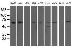Image no. 6 for anti-alpha-Fetoprotein (AFP) antibody (ABIN1496485)