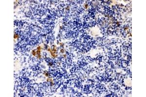 IHC-P: Leupaxin antibody testing of rat spleen tissue