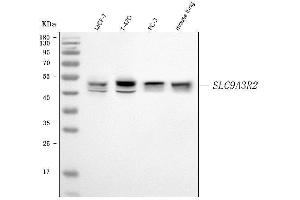 Western blot analysis of SLC9A3R2 using anti-SLC9A3R2 antibody (ABIN7599271).