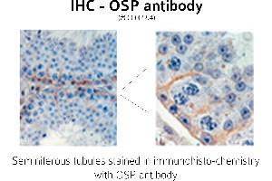 Image no. 1 for anti-Claudin 11 (CLDN11) (C-Term) antibody (ABIN346949) (Claudin 11 anticorps  (C-Term))