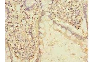 Immunohistochemistry of paraffin-embedded human small intestine tissue using ABIN7166436 at dilution of 1:100 (EEF2KMT (AA 1-330) anticorps)