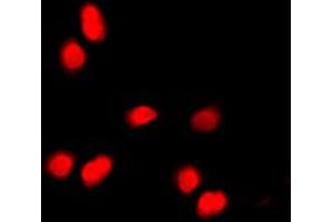 Immunofluorescent analysis of Histone H3 (pT11) staining in HepG2 cells. (Histone 3 anticorps  (pSer11))