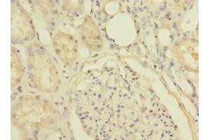 Immunohistochemistry of paraffin-embedded human kidney tissue using ABIN7170191 at dilution of 1:100 (SLC25A36 anticorps  (AA 58-110))