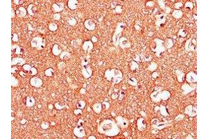 Immunohistochemistry of paraffin-embedded human brain tissue using ABIN7143307 at dilution of 1:100 (Adenosine A2b Receptor anticorps  (AA 292-332))