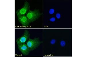 ABIN185043 Immunofluorescence analysis of paraformaldehyde fixed A431 cells, permeabilized with 0. (BCOR anticorps  (N-Term))