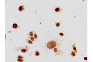 Immunocytochemistry analysis of MCF-7 cells using ABIN7139591 at dilution of 1:100