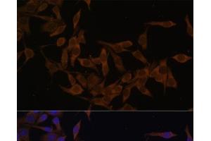 anti-Ubiquitin-Conjugating Enzyme E2L 3 (UBE2L3) antibody