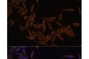 Immunofluorescence analysis of HeLa cells using UBE2L3 Polyclonal Antibody at dilution of 1:100 (40x lens). (UBE2L3 anticorps)