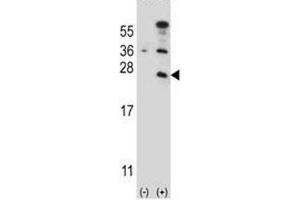 Western blot analysis of CD3e antibody and 293 cell lysate (2 ug/lane) either nontransfected (Lane 1) or transiently transfected (2) with the CD3E gene.